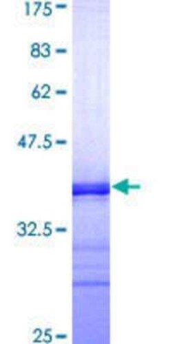 Novus Biologicals Recombinant Human Somatostatin R1/SSTR1 GST (N-Term) Protein 10 &mu;g | Buy Online | Novus Biologicals&trade; | Fisher Scientific