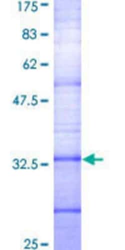 Novus Biologicals Recombinant Human Somatostatin R2/SSTR2 GST (N-Term) Protein 25 &mu;g | Buy Online | Novus Biologicals&trade; | Fisher Scientific