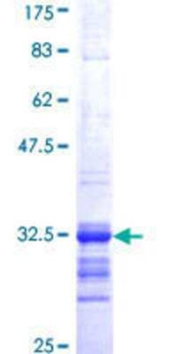 Novus Biologicals Recombinant Human Somatostatin R2/SSTR2 GST (N-Term) Protein 10 &mu;g | Buy Online | Novus Biologicals&trade; | Fisher Scientific