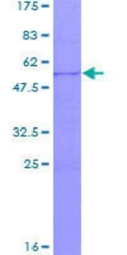Novus Biologicals Recombinant Human SSX4 GST (N-Term) Protein 10 &mu;g | Buy Online | Novus Biologicals&trade; | Fisher Scientific