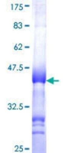 Novus Biologicals Recombinant Human SSX4 GST (N-Term) Protein 25 &mu;g | Buy Online | Novus Biologicals&trade; | Fisher Scientific