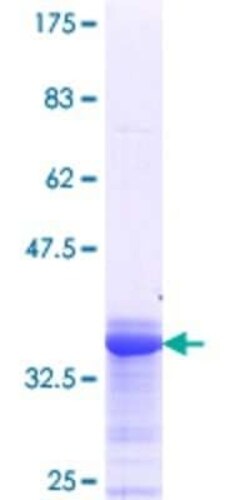 Novus Biologicals Recombinant Human SS18 GST (N-Term) Protein 10 &mu;g | Buy Online | Novus Biologicals&trade; | Fisher Scientific