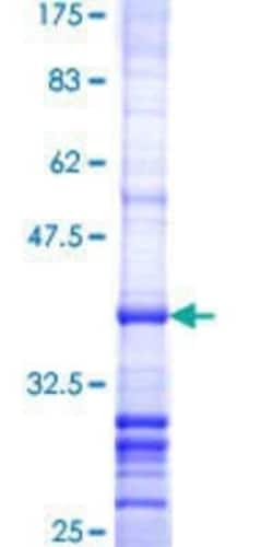Novus Biologicals Recombinant Human ST5 GST (N-Term) Protein 10 &mu;g | Buy Online | Novus Biologicals&trade; | Fisher Scientific