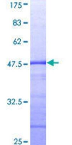Novus Biologicals Recombinant Human STAT2 GST (N-Term) Protein 10 &mu;g | Buy Online | Novus Biologicals&trade; | Fisher Scientific