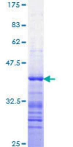 Novus Biologicals&trade;&nbsp;Recombinant Human STAT3 GST (N-Term) Protein
