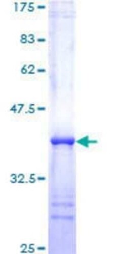 Novus Biologicals Recombinant Human STAT5A GST (N-Term) Protein 10 &mu;g | Buy Online | Novus Biologicals&trade; | Fisher Scientific