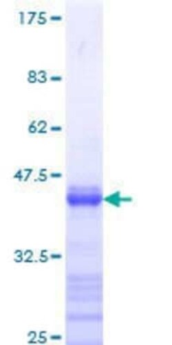 Novus Biologicals Recombinant Human STAT5b GST (N-Term) Protein 25 &mu;g | Buy Online | Novus Biologicals&trade; | Fisher Scientific