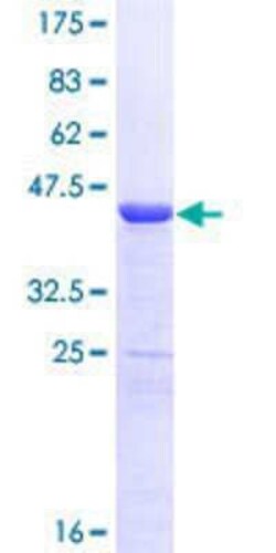 Novus Biologicals Recombinant Human STAT6 GST (N-Term) Protein 25 &mu;g | Buy Online | Novus Biologicals&trade; | Fisher Scientific