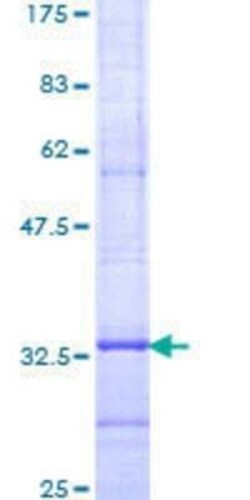 Novus Biologicals Recombinant Human ELOVL4 GST (N-Term) Protein 10 &mu;g | Buy Online | Novus Biologicals&trade; | Fisher Scientific