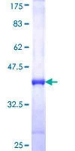 Novus Biologicals Recombinant Human NEK4 GST (N-Term) Protein 25 &mu;g | Buy Online | Novus Biologicals&trade; | Fisher Scientific