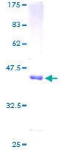 Novus Biologicals Recombinant Human LOK GST (N-Term) Protein 10 &mu;g | Buy Online | Novus Biologicals&trade; | Fisher Scientific