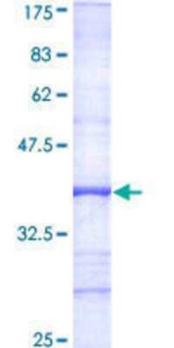 Novus Biologicals Recombinant Human LOK GST (N-Term) Protein 10 &mu;g | Buy Online | Novus Biologicals&trade; | Fisher Scientific