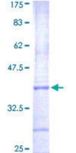 Novus Biologicals Recombinant Human Aurora C GST (N-Term) Protein 10 &mu;g | Buy Online | Novus Biologicals&trade; | Fisher Scientific