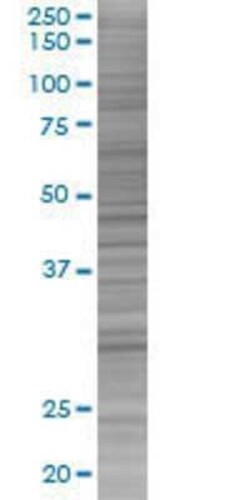 Novus Biologicals Syntaxin 1A 293T Cell Transient Overexpression Lysate 0.1 mL | Buy Online | Novus Biologicals&trade; | Fisher Scientific