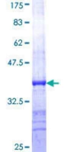 Novus Biologicals&trade;&nbsp;Recombinant Human Syntaxin-BP1 GST (N-Term) Protein