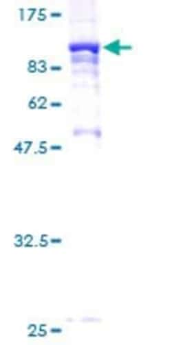 Novus Biologicals Recombinant Human Syntaxin-BP2 GST (N-Term) Protein 10 &mu;g | Buy Online | Novus Biologicals&trade; | Fisher Scientific