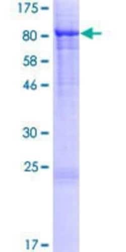 Novus Biologicals Recombinant Human Syntaxin-BP3/Munc18c GST (N-Term) Protein 10 &mu;g | Buy Online | Novus Biologicals&trade; | Fisher Scientific