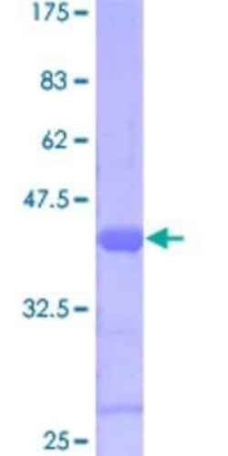 Novus Biologicals Recombinant Human Suppressor of Ty 4 homolog 1 GST (N-Term) Protein 25 &mu;g | Buy Online | Novus Biologicals&trade; | Fisher Scientific