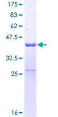 Novus Biologicals Recombinant Human Suppressor of Ty 4 homolog 1 GST (N-Term) Protein 10 &mu;g | Buy Online | Novus Biologicals&trade; | Fisher Scientific
