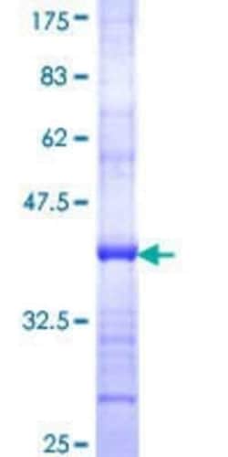 Novus Biologicals Recombinant Human Suppressor of Ty 4 homolog 1 GST (N-Term) Protein 10 &mu;g | Buy Online | Novus Biologicals&trade; | Fisher Scientific