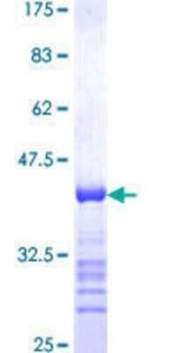 Novus Biologicals Recombinant Human SUV3L1 GST (N-Term) Protein 10 &mu;g | Buy Online | Novus Biologicals&trade; | Fisher Scientific