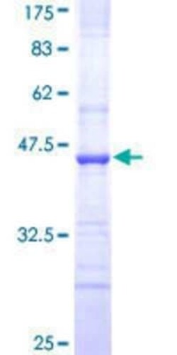 Novus Biologicals Recombinant Human SUR1 GST (N-Term) Protein 25 &mu;g | Buy Online | Novus Biologicals&trade; | Fisher Scientific