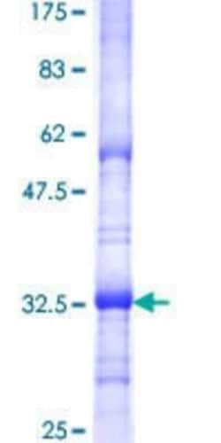 Novus Biologicals Recombinant Human SURF4 GST (N-Term) Protein 10 &mu;g | Buy Online | Novus Biologicals&trade; | Fisher Scientific