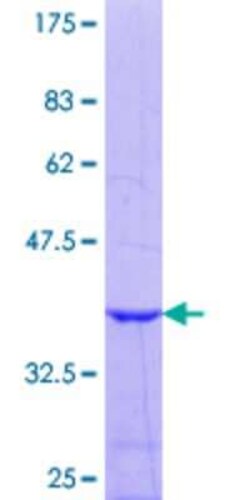 Novus Biologicals Recombinant Human SURF5 GST (N-Term) Protein 25 &mu;g | Buy Online | Novus Biologicals&trade; | Fisher Scientific
