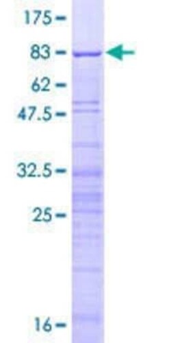 Novus Biologicals Recombinant Human Surf6 GST (N-Term) Protein 10 &mu;g | Buy Online | Novus Biologicals&trade; | Fisher Scientific