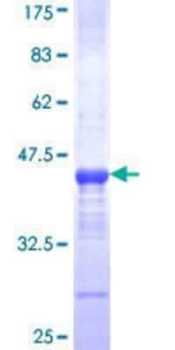 Novus Biologicals Recombinant Human Brachyury GST (N-Term) Protein 25 &mu;g | Buy Online | Novus Biologicals&trade; | Fisher Scientific