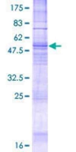 Novus Biologicals Recombinant Human NK1R GST (N-Term) Protein 2 &mu;g | Buy Online | Novus Biologicals&trade; | Fisher Scientific