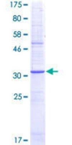 Novus Biologicals Recombinant Human NK1R GST (N-Term) Protein 10 &mu;g | Buy Online | Novus Biologicals&trade; | Fisher Scientific