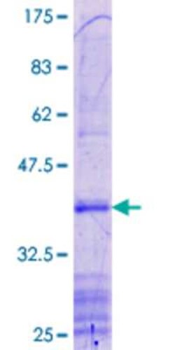 Novus Biologicals Recombinant Human NK1R GST (N-Term) Protein 25 &mu;g | Buy Online | Novus Biologicals&trade; | Fisher Scientific