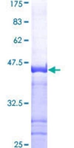 Novus Biologicals Recombinant Human KAT4/TBP Associated Factor 1 GST (N-Term) Protein 10 &mu;g | Buy Online | Novus Biologicals&trade; | Fisher Scientific