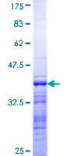 Novus Biologicals Recombinant Human TAF2 GST (N-Term) Protein 25 &mu;g | Buy Online | Novus Biologicals&trade; | Fisher Scientific