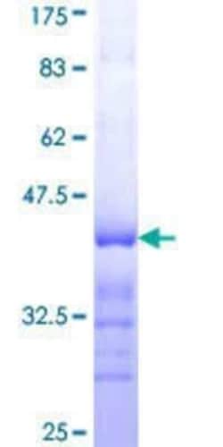 Novus Biologicals Recombinant Human Taf4 GST (N-Term) Protein 25 &mu;g | Buy Online | Novus Biologicals&trade; | Fisher Scientific
