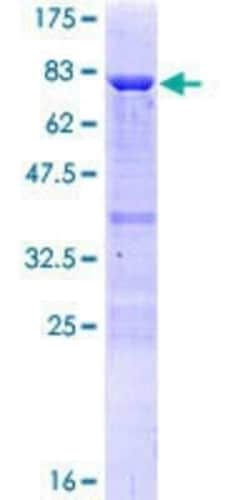 Novus Biologicals Recombinant Human TAF7 GST (N-Term) Protein 10 &mu;g | Buy Online | Novus Biologicals&trade; | Fisher Scientific