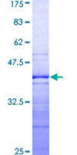 Novus Biologicals Recombinant Human TAF7 GST (N-Term) Protein 10 &mu;g | Buy Online | Novus Biologicals&trade; | Fisher Scientific