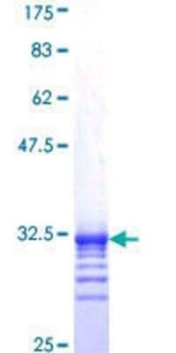 Novus Biologicals Recombinant Human TAF11 GST (N-Term) Protein 25 &mu;g | Buy Online | Novus Biologicals&trade; | Fisher Scientific
