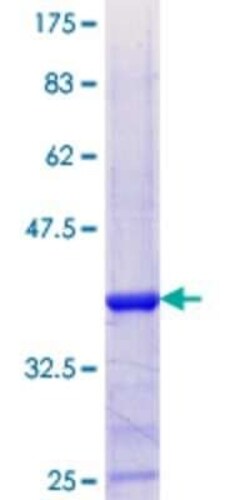 Novus Biologicals Recombinant Human TAF13 GST (N-Term) Protein 25 &mu;g | Buy Online | Novus Biologicals&trade; | Fisher Scientific