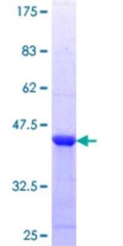 Novus Biologicals Recombinant Human TAK1 GST (N-Term) Protein 25 &mu;g | Buy Online | Novus Biologicals&trade; | Fisher Scientific