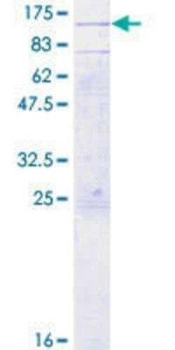 Novus Biologicals Recombinant Human TAP2 GST (N-Term) Protein 2 &mu;g | Buy Online | Novus Biologicals&trade; | Fisher Scientific