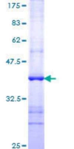 Novus Biologicals Recombinant Human Tapasin GST (N-Term) Protein 10 &mu;g | Buy Online | Novus Biologicals&trade; | Fisher Scientific