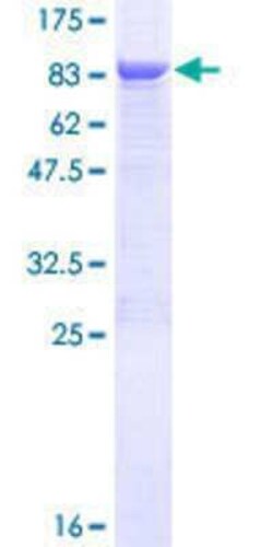 Novus Biologicals Recombinant Human TBCE GST (N-Term) Protein 25 &mu;g | Buy Online | Novus Biologicals&trade; | Fisher Scientific