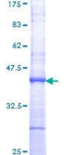 Novus Biologicals Recombinant Human TATA binding protein TBP GST (N-Term) Protein 10 &mu;g | Buy Online | Novus Biologicals&trade; | Fisher Scientific
