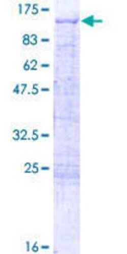 Novus Biologicals Recombinant Human TBX2 GST (N-Term) Protein 2 &mu;g | Buy Online | Novus Biologicals&trade; | Fisher Scientific