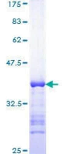 Novus Biologicals Recombinant Human TBX2 GST (N-Term) Protein 25 &mu;g | Buy Online | Novus Biologicals&trade; | Fisher Scientific