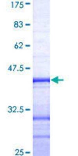 Novus Biologicals Recombinant Human TBX5 GST (N-Term) Protein 10 &mu;g | Buy Online | Novus Biologicals&trade; | Fisher Scientific