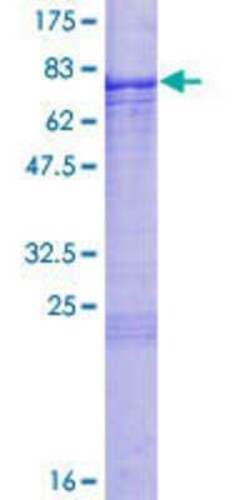 Novus Biologicals Recombinant Human TBX6 GST (N-Term) Protein 10 &mu;g | Buy Online | Novus Biologicals&trade; | Fisher Scientific