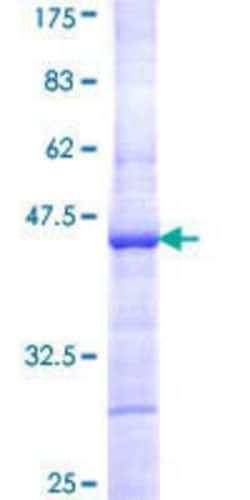 Novus Biologicals Recombinant Human TBX6 GST (N-Term) Protein 10 &mu;g | Buy Online | Novus Biologicals&trade; | Fisher Scientific